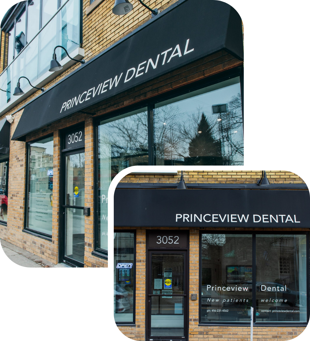 Two views of the exterior of Princeview Dental clinic at 3052, showing large glass windows, a brick facade, and a black awning with the clinic name in white letters.